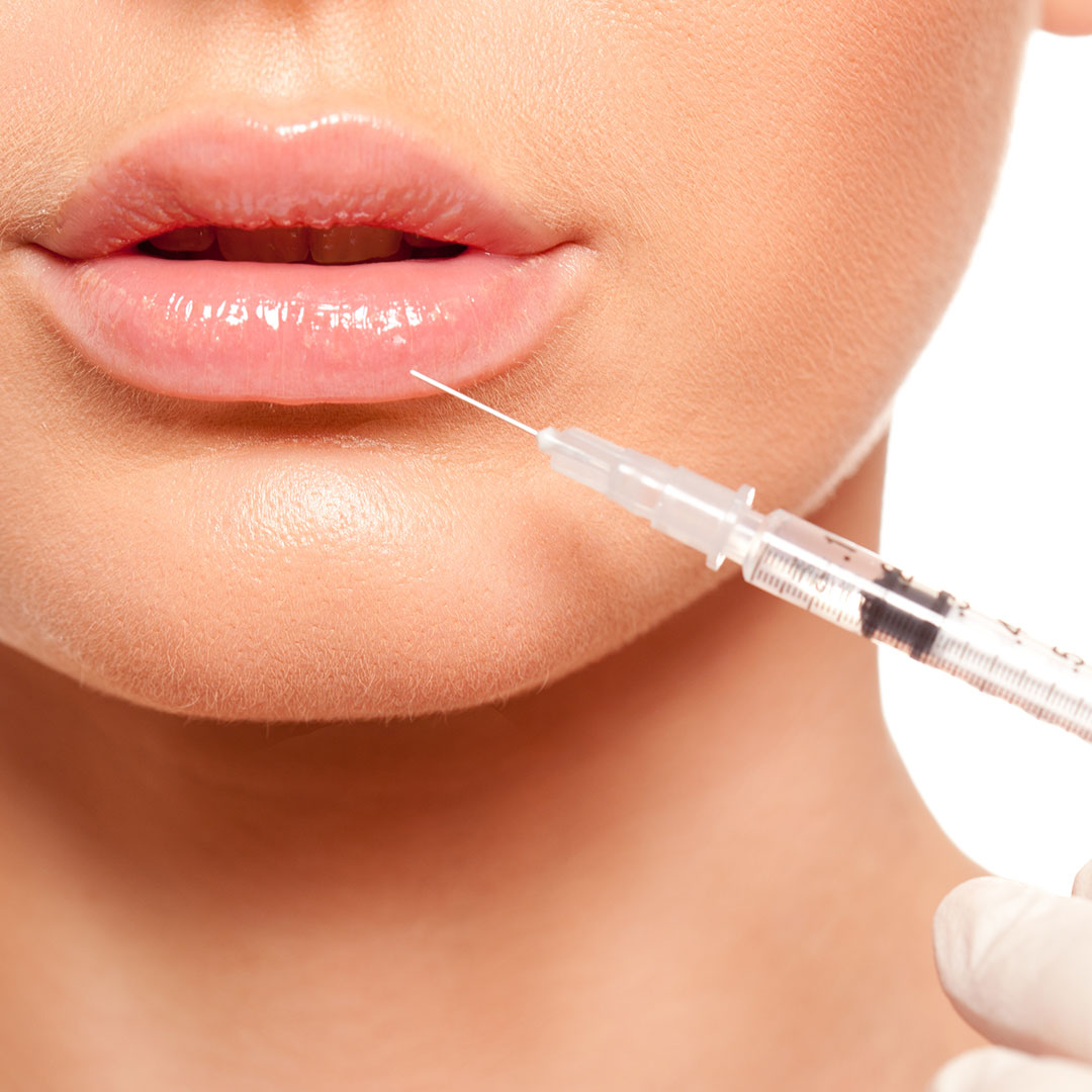 Botox Lip Injections And Filler In Corvallis Oregon Adore Salon Aesthetics