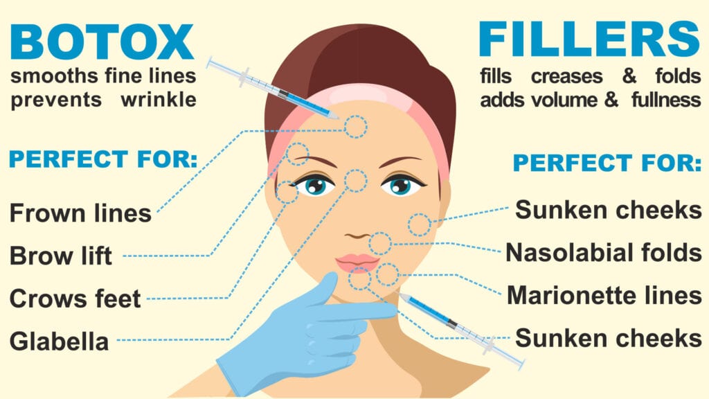 botox filler info graphic